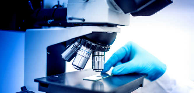 HPV co-test - metoda wykrywania ryzyka rozwoju raka szyjki macicy