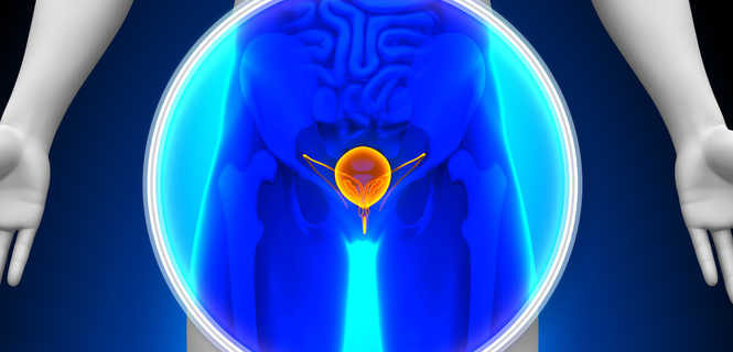 Leczenie łagodnego przerostu prostaty metodą embolizacji tętnic