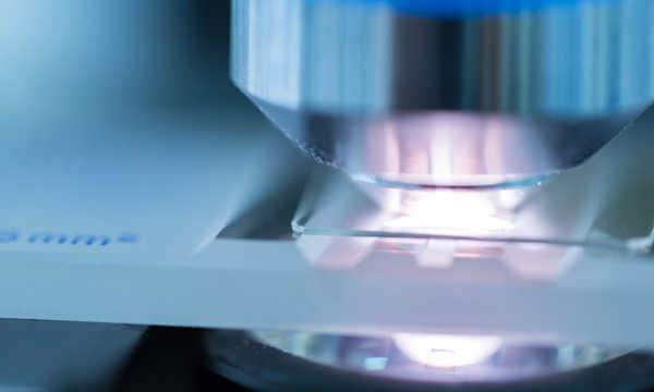 Test HPV warto wykonać w celu wykrycia obecności wirusa brodawczaka ludzkiego, który może prowadzić do rozwoju raka szyjki macicy