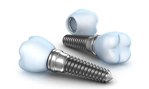 Czy implanty zębów są bezpieczne?