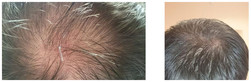 Mikropigmentacja - zagęszczenie naturalnych włosów przed i po zabiegu