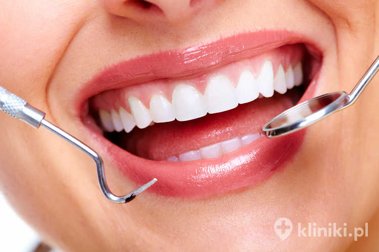 Aparaty ortodontyczne