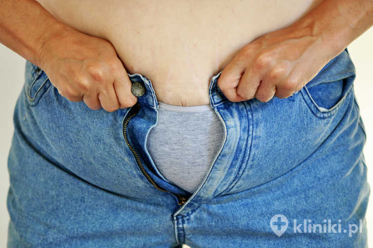 Do zalet plikacji żołądka zalicza się brak usunięcia fragmentu żołądka i brak implantów, krótszy pobyt w szpitalu