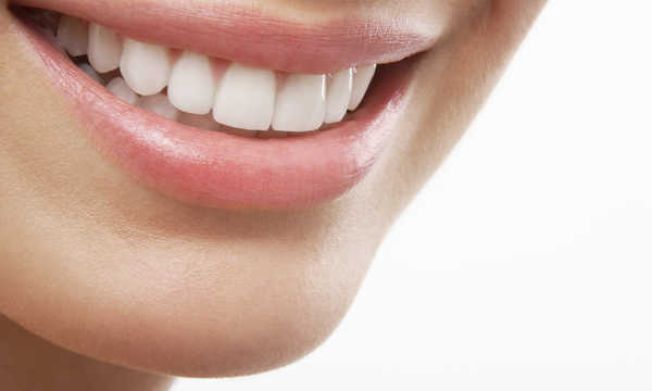 Ultracienkie licówki porcelanowe