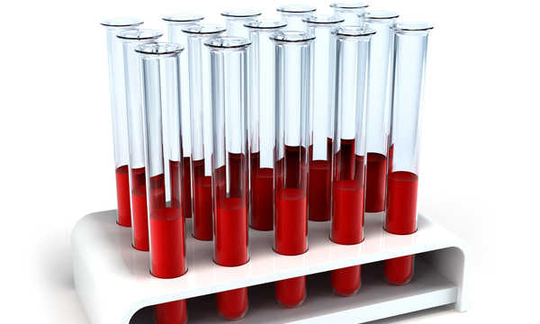 Osocze bogatopłytkowe