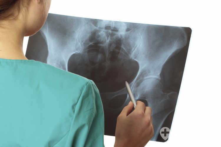 Endoprotezoplastyka powierzchniowa stawu biodrowego może stanowić alternatywę dla klasycznej endoprotezy u pacjentów spełniających określone kryteria medyczne