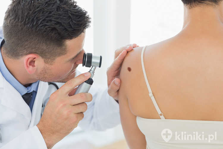 Jakie schorzenia leczy dermatolog?