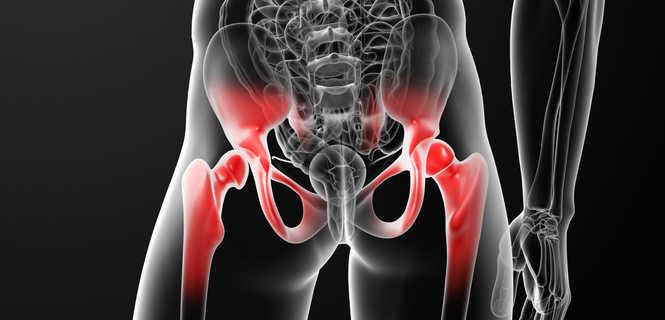 Alloplastyka stawu biodrowego