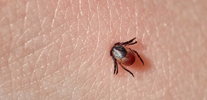 Borelioza po ukąszeniu kleszcza: objawy i zapobieganie