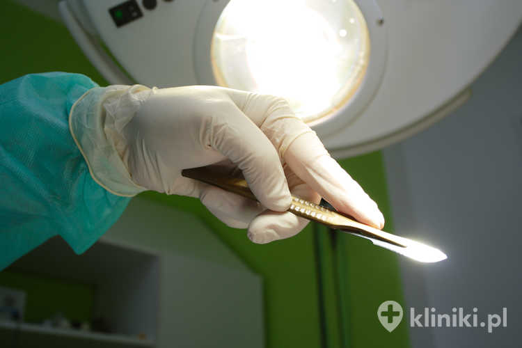 Usuwanie tłuszczaków