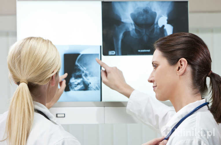 Zabieg alloplastyki stawu biodrowego pozwala na odzyskanie sprawności i samodzielności w codziennym funkcjonowaniu