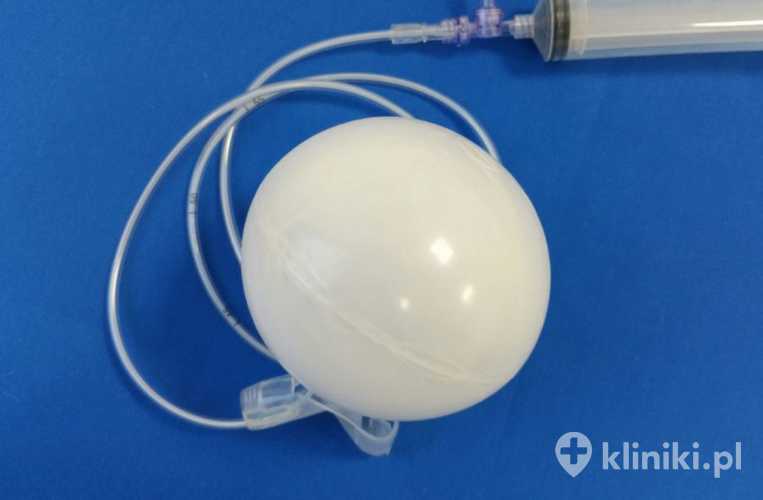 Balon gastryczny BIB to endoskopowo wprowadzany do żołądka silikonowy balon wypełniany solą fizjologiczną, który ogranicza objętość żołądka
