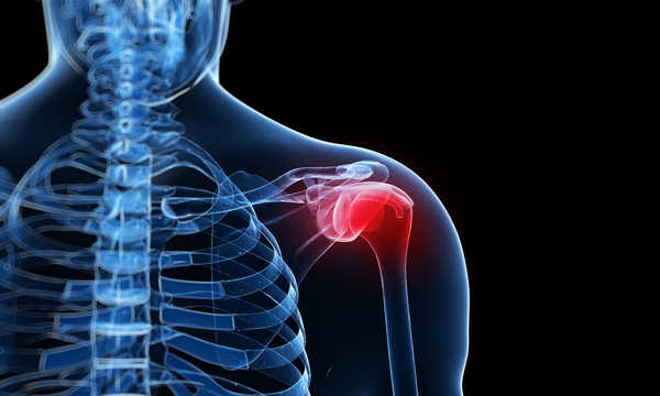 Schorzenia i urazy barku takie jak uszkodzenia stożka rotatorów często kwalifikują się do operacji w przypadku znacznego przerwania ciągłości ścięgien