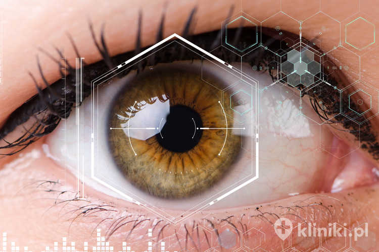 Laserowe leczenie zaćmy w wybranych przypadkach pozwala na skrócenie czasu zabiegu i zmniejszenie obciążenia dla oka