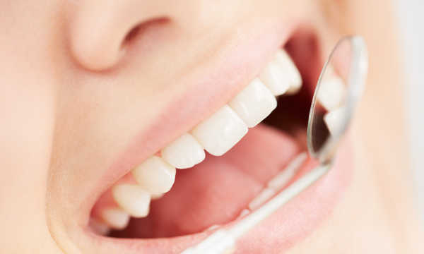 Nakładkowe wybielanie zębów