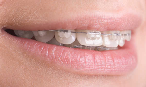 Jak długo trwa kontrolna wizyta ortodontyczna?