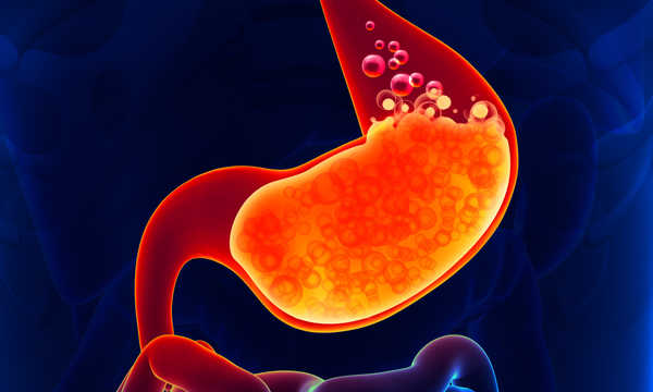 Rękawowa resekcja żołądka to jedna z najczęściej wykonywanych operacji bariatrycznych