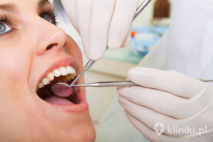 Systematyczne wizyty u dentysty umożliwiają wyleczenie ubytku wówczas, gdy jest on jeszcze niewielki