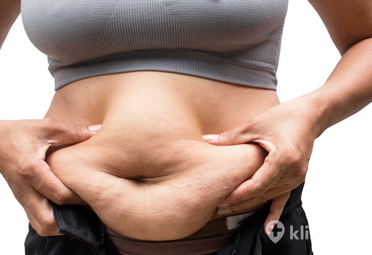 Abdominoplastyka po ciąży