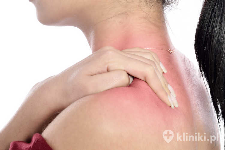 Podanie blokady ortopedycznej wykonuje się zazwyczaj pod kontrolą USG, co zwiększa precyzję i bezpieczeństwo zabiegu