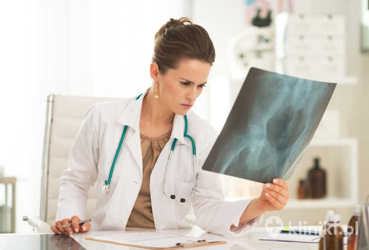 Rehabilitacja po alloplastyce biodra rozpoczyna się już następnego dnia po operacji