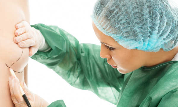 Chirurg rysuje na piersi kobiety miejsca wszczepienia implantu