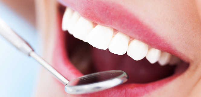 Kiedy lakować zęby?