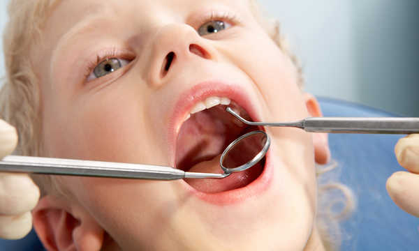 Leczenie zębów mlecznych - kolorowe wypełnienie