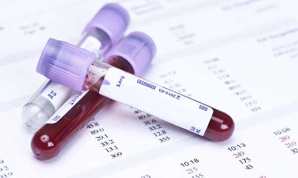Na czym polega badanie hematologiczne?