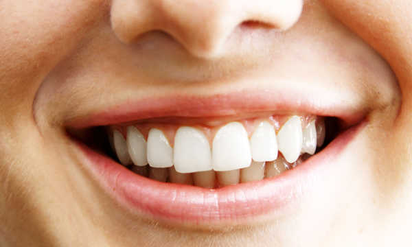 Implanty zygomatyczne są stosowane w przypadkach, w których klasyczne implanty nie mogą być bezpiecznie wszczepione