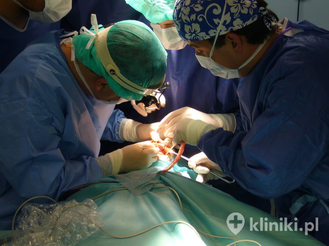 W Polsce najczęściej wykorzystywane są implanty zygomatyczne firmy Nobel - Zygoma Branemark