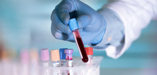 Osocze bogatopłytkowe i komórki macierzyste w bio ortopedii