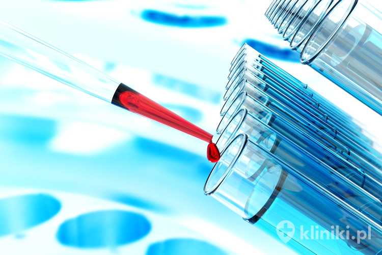 Osocze bogatopłytkowe i komórki macierzyste w medycynie estetycznej poprawiają koloryt skóry i przyczyniają się do jej odmłodzenia